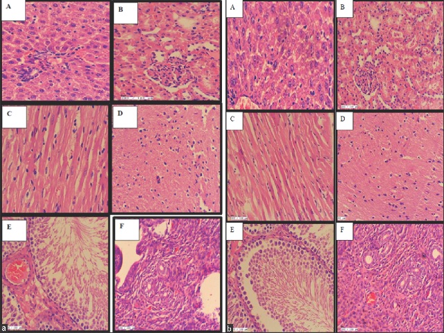 Evaluation of toxicity studies and anti-inflammatory activity of ...